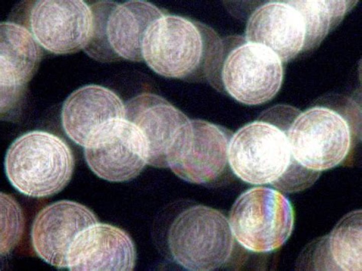 Orbs