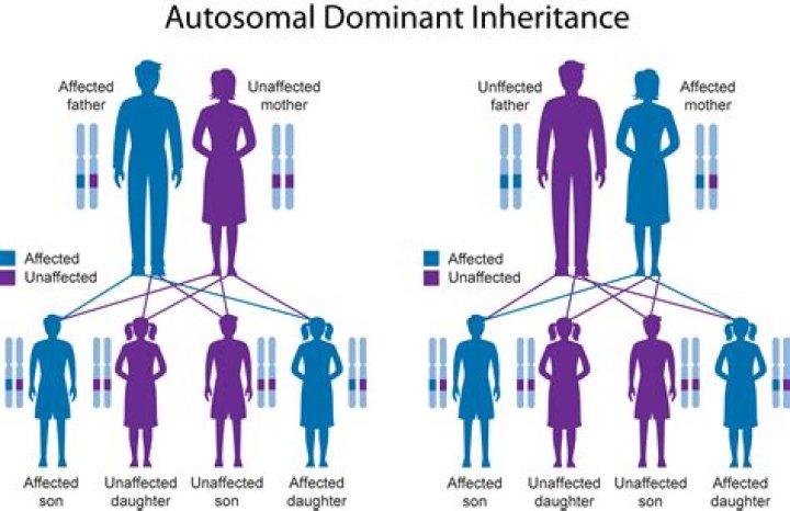 What determines SPECIAL inheritance in children?